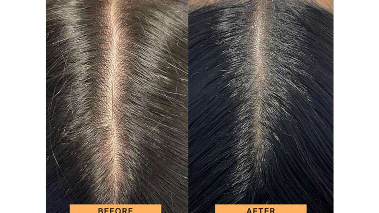 Weak, brittle, oily, dry hair, slow regrowth … ?