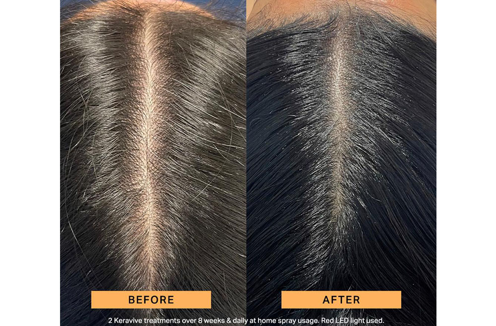 Weak, brittle, oily, dry hair, slow regrowth … ?